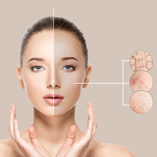 Moisturizer production line at HCP Wellness – trusted private label manufacturer in India