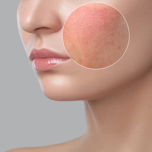 Private Label Cream Moisturizer Manufacturers – Moisturizer Cream Production at HCP Wellness